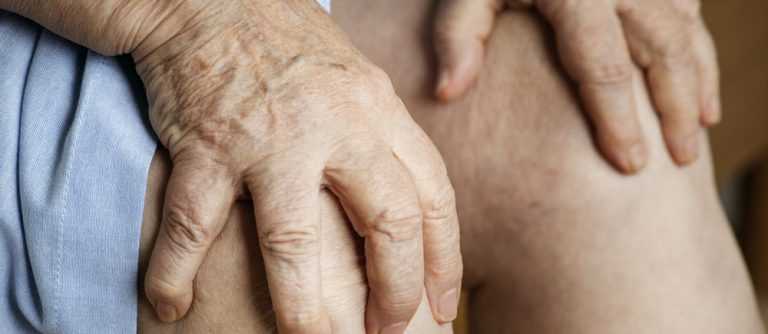 piernas hinchadas